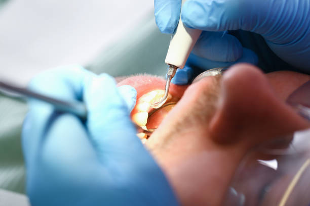 Best Orthodontic Emergency Dentist in Woodlands, CA